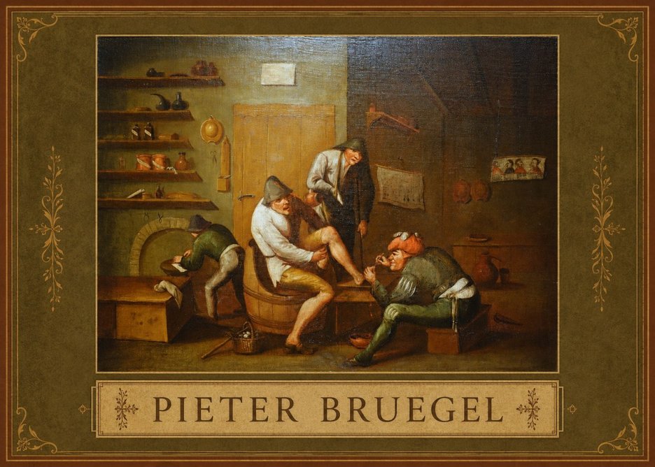 Pieter Bruegel The Foot Operation No1 - Juliste