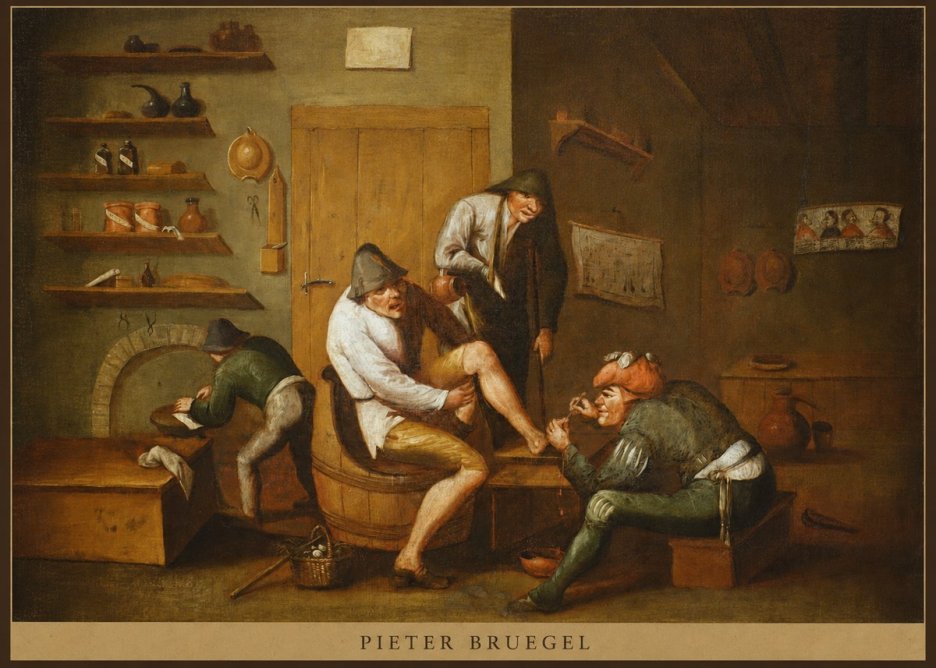 Pieter Bruegel The Foot Operation No5 - Juliste